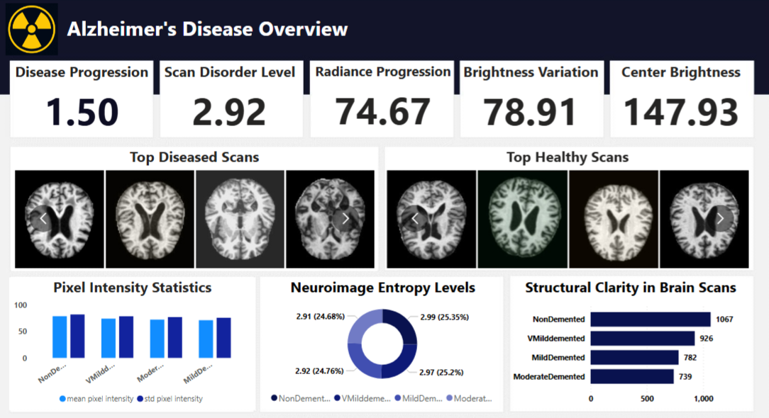 Alzheimer's Dashboard Overview